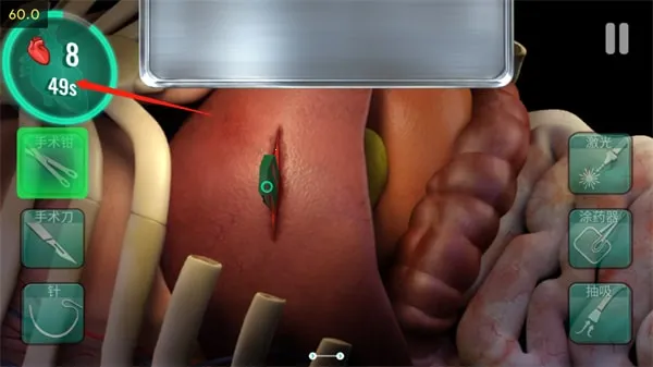 ҽԺ����ʱ��2026���ذ�װ