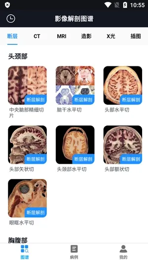 影像解剖图谱(医学影像学习平台) 影像解剖图谱(医学影像学习平台)
