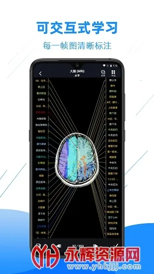 Ӱ�����ͼ��(ҽѧӰ��ѧϰƽ̨)v4.6.5 �ٷ�����